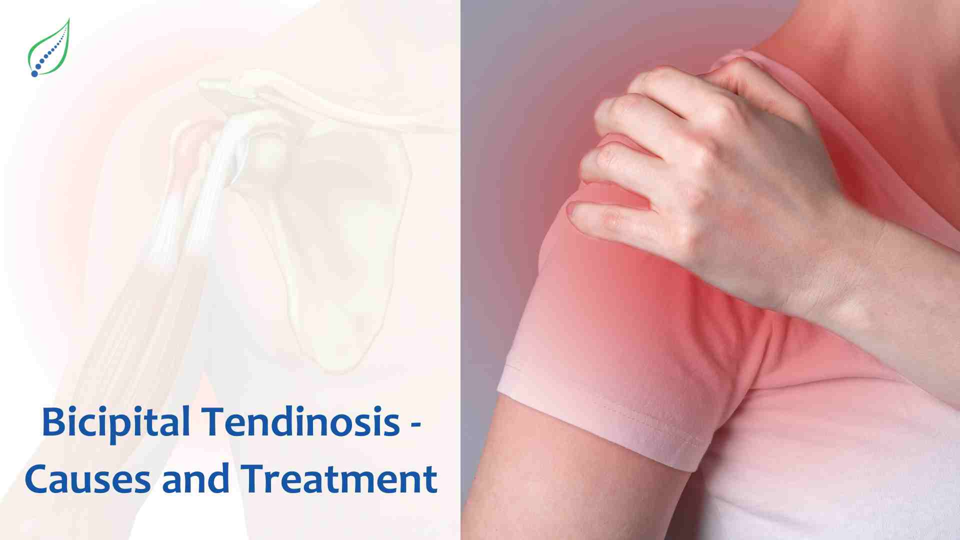 Bicipital Tendinosis - Causes and Treatment